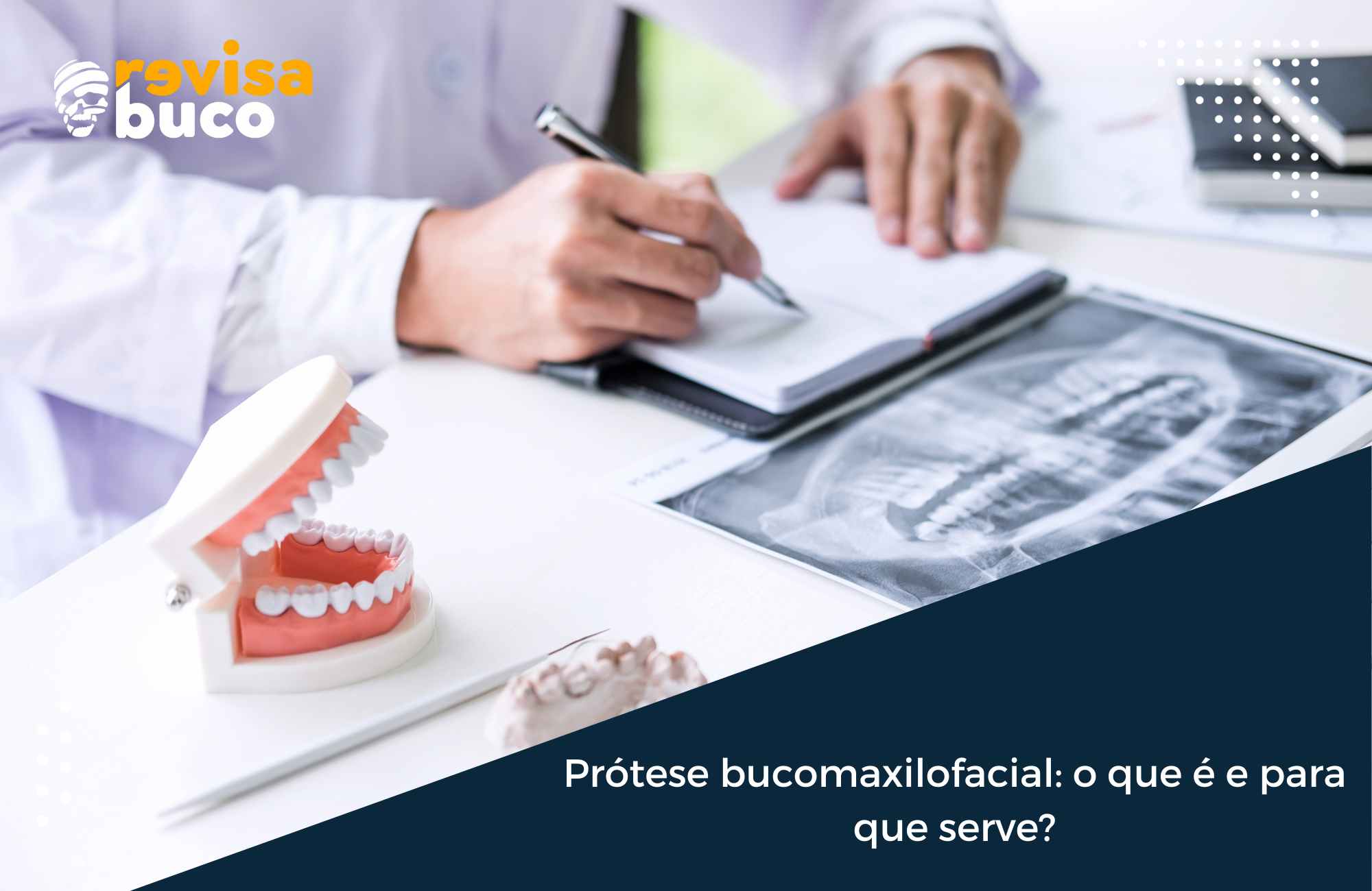 Prótese bucomaxilofacial o que é e para que serve