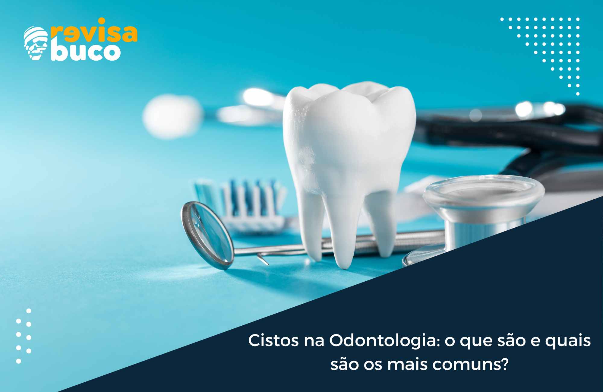 Cistos na Odontologia o que são e quais são os mais comuns