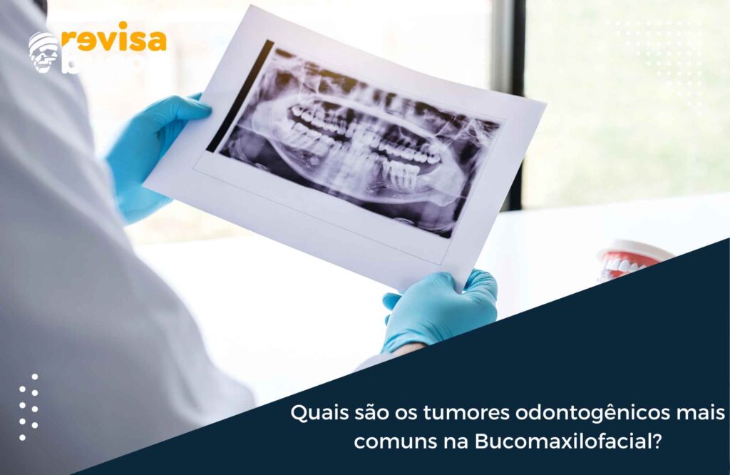 Quais são os tumores odontogênicos mais comuns na Bucomaxilofacial