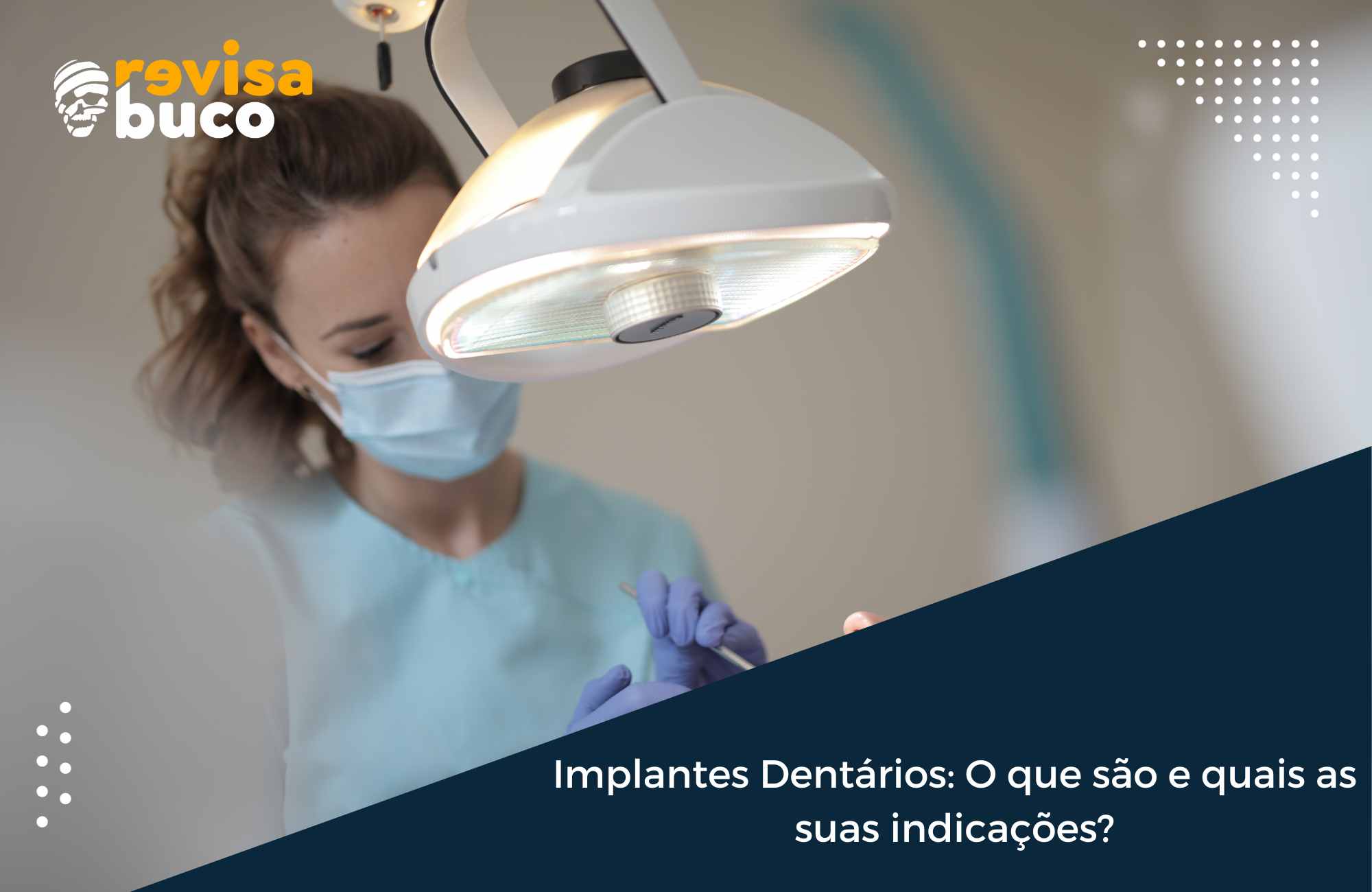 Implantes Dentários O que são e quais as suas indicações